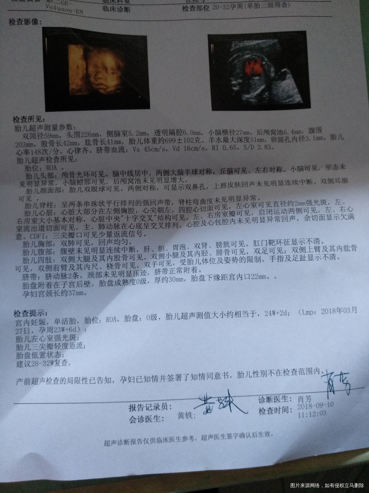 这是今天做的的四维彩超,正常吗?好担心