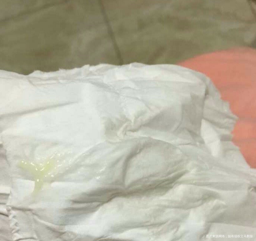 移植十一天中间偶尔小便都会擦出黄色分泌物请问是说明没有着床成功吗?