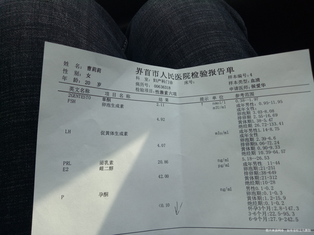 姐姐们,今天医生让查了激素六项!说是多囊卵巢!