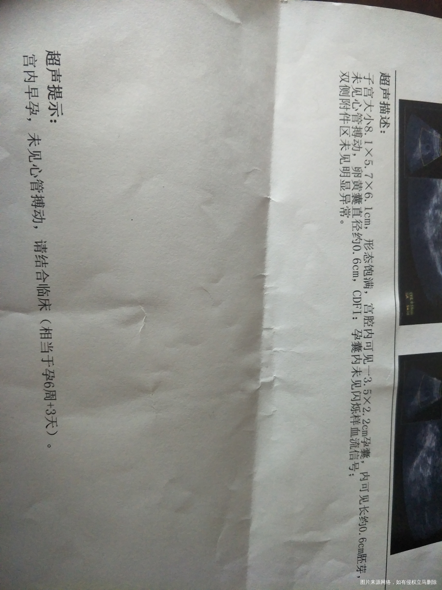 急求帮忙看看,什么情况?