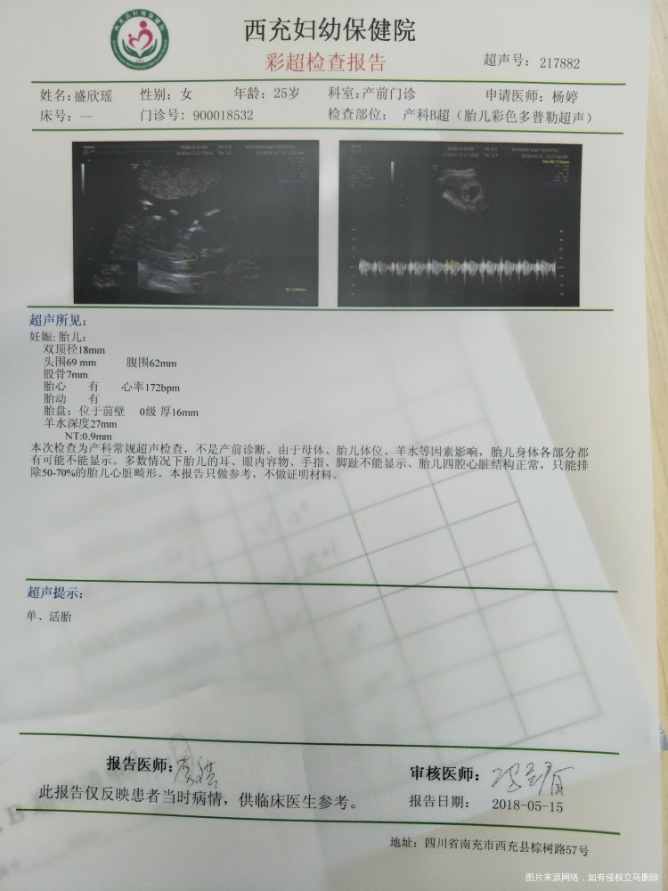 医生说NT过了,开心,但是羊水是不是有点少?
