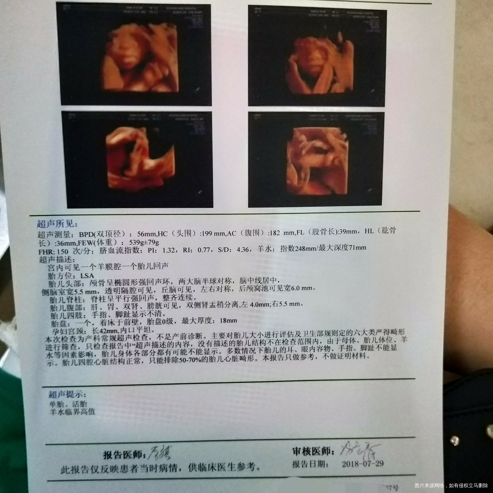 请问医生羊水过多怎么办