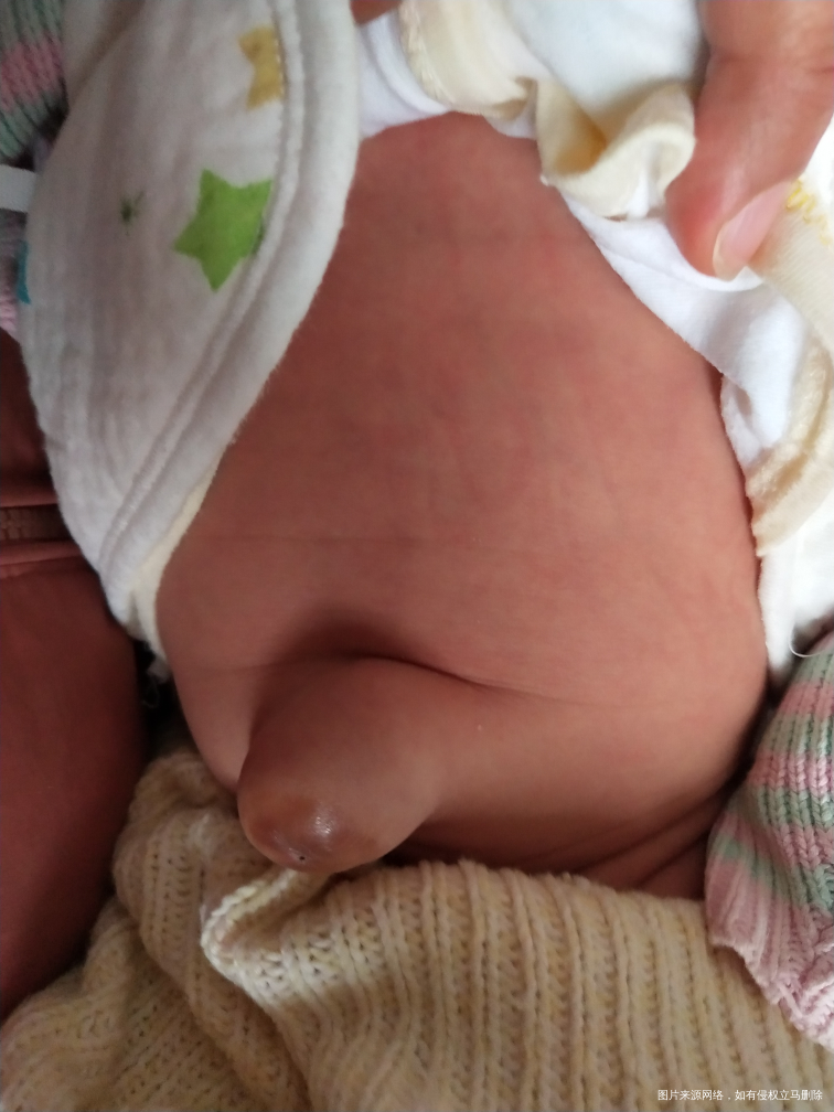 求医生帮忙看一下,宝宝一个