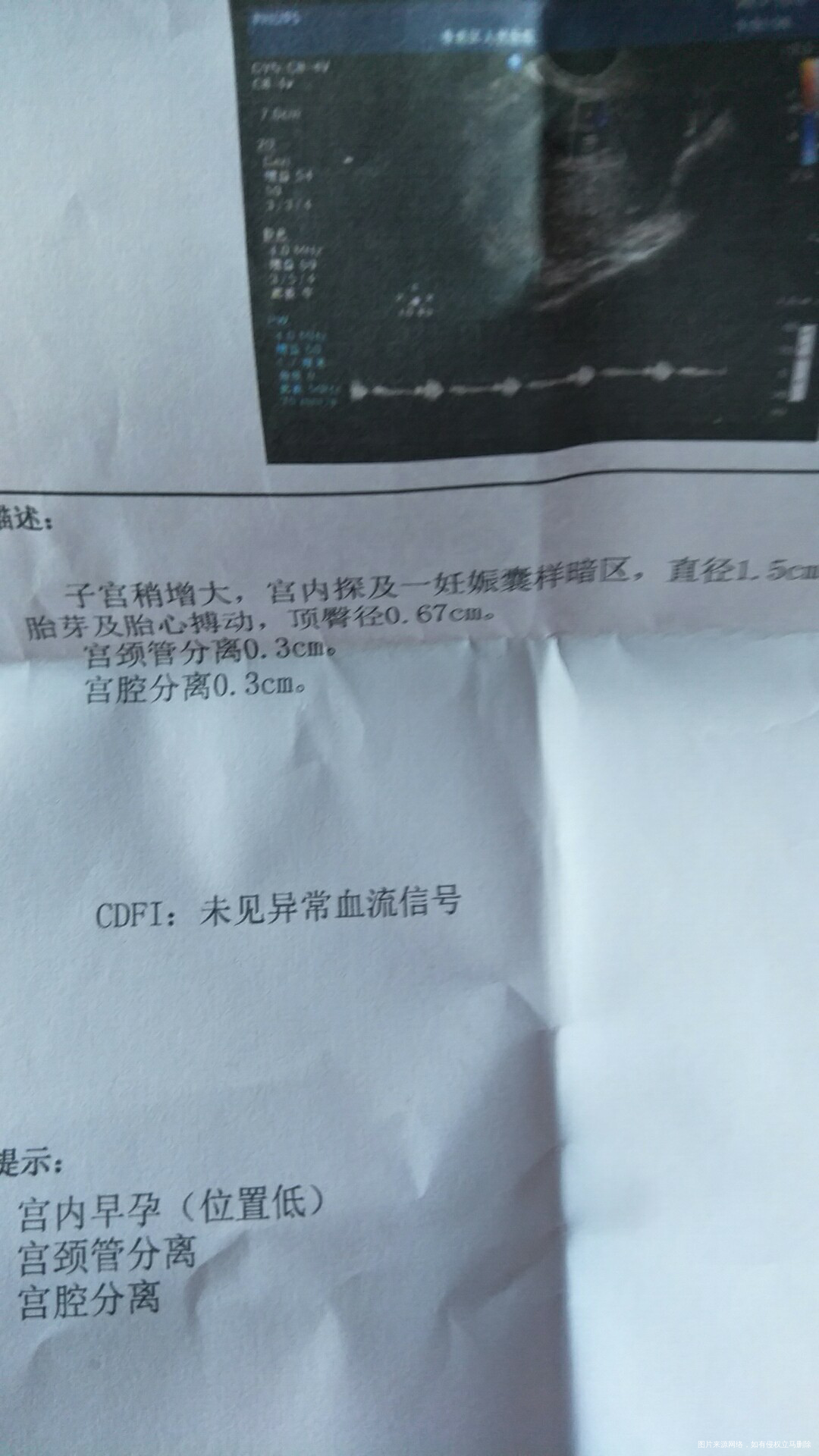 怀孕7周流血了怎么回事