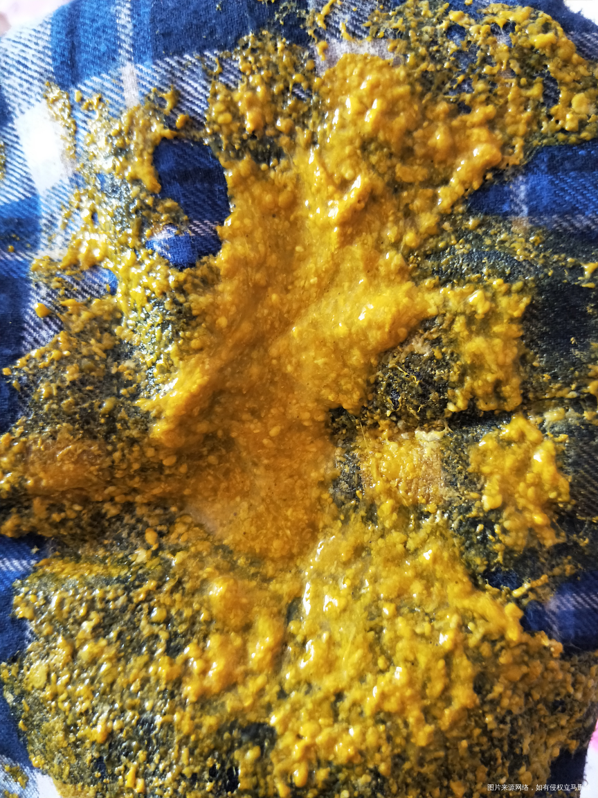 急急急,宝宝这样到底怎么弄