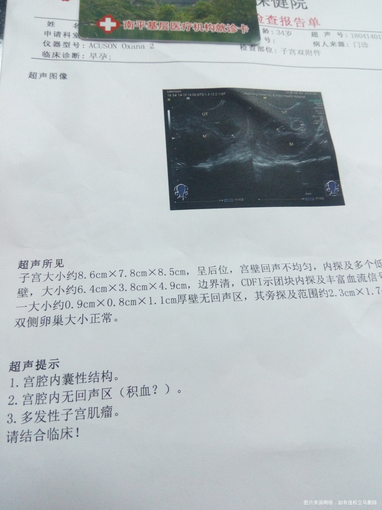 请帮忙看看,给点儿经验