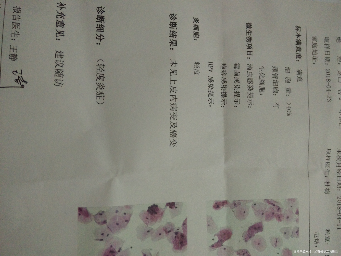 请医生帮我评估一下我能不能自然怀孕