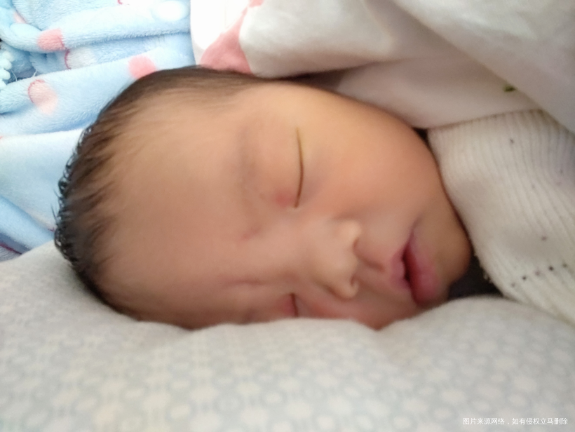 你们家宝贝都长胎记了吗