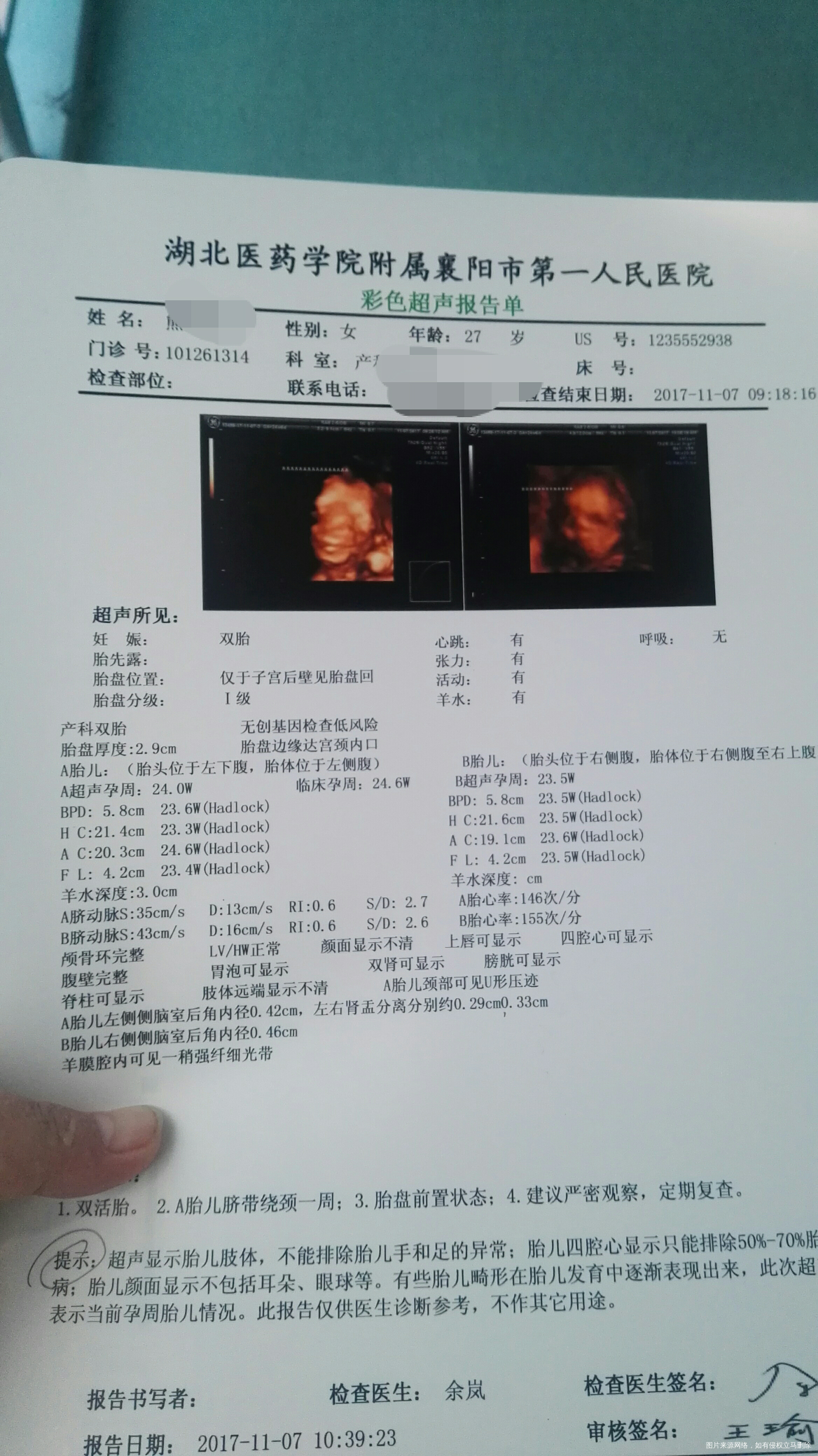 双胎四维大排畸归来,麻烦医生给看看,胎盘低置,偏小一周,还有双肾盂分离