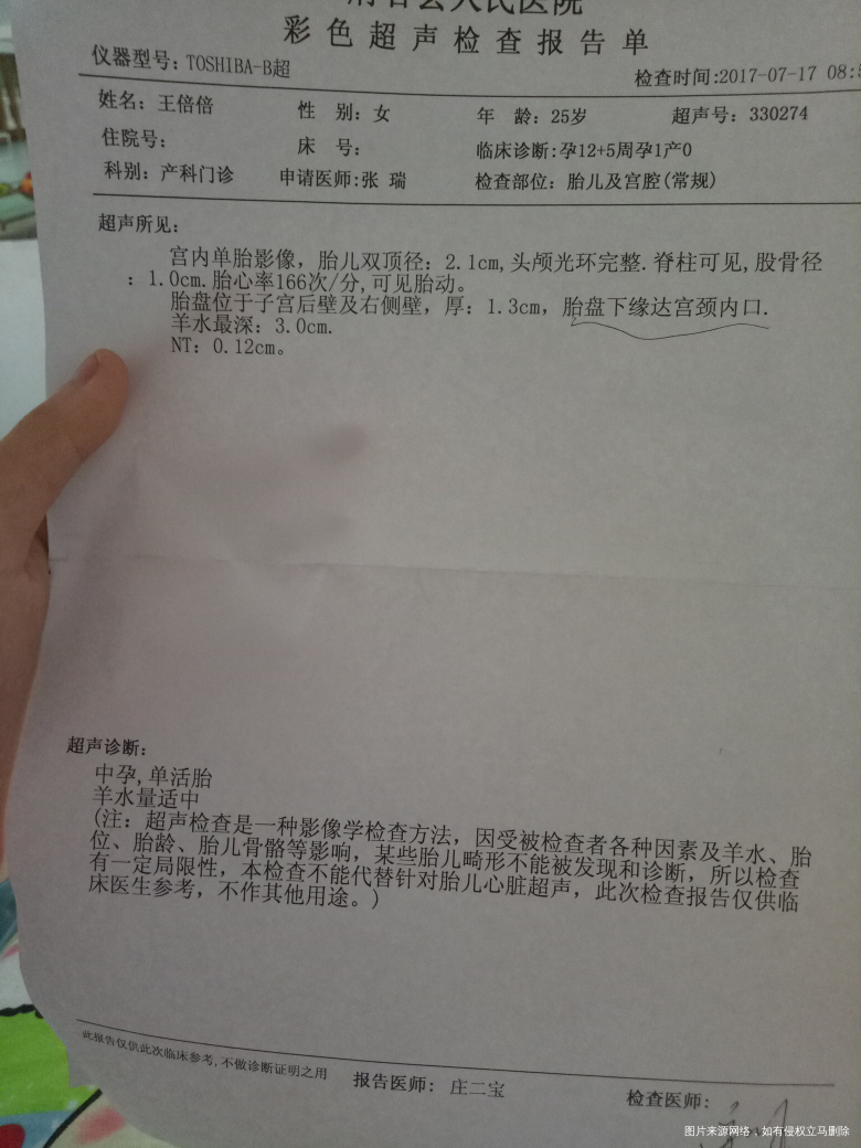 今天做完NT有出血严重吗