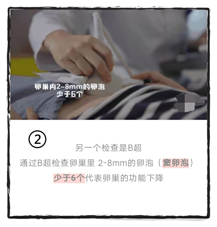 怎么判断自己有没有卵巢功能下降,看这里👇👇👇