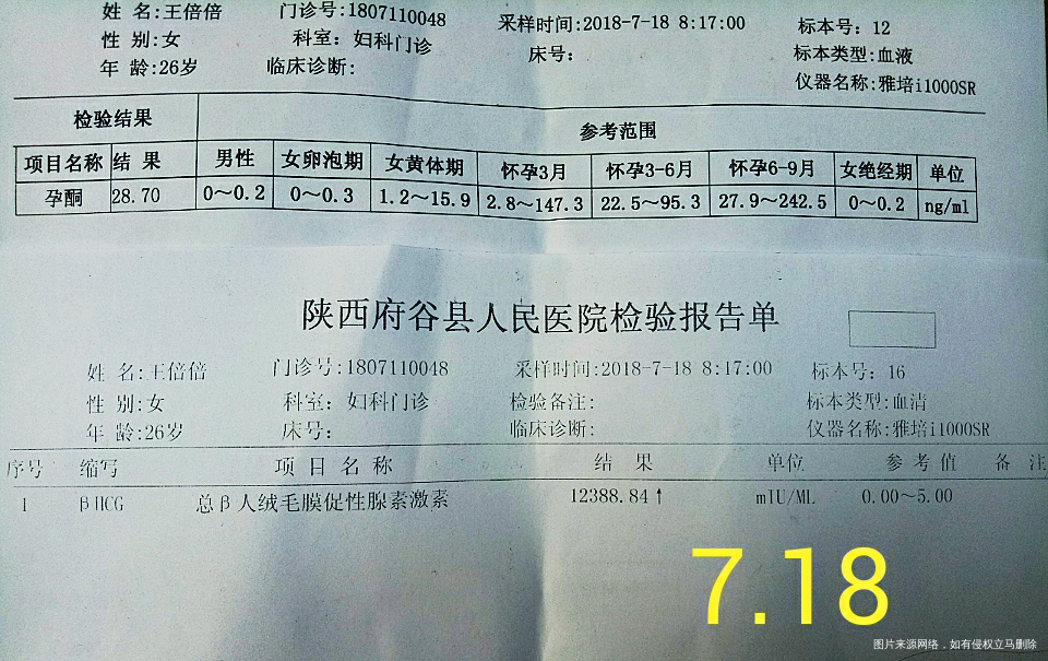 医生,保胎针可以直接停掉吗