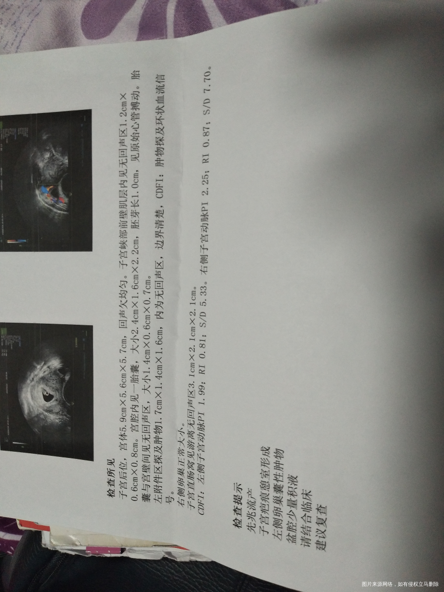 求求求路过的医生帮忙看看,很急的。