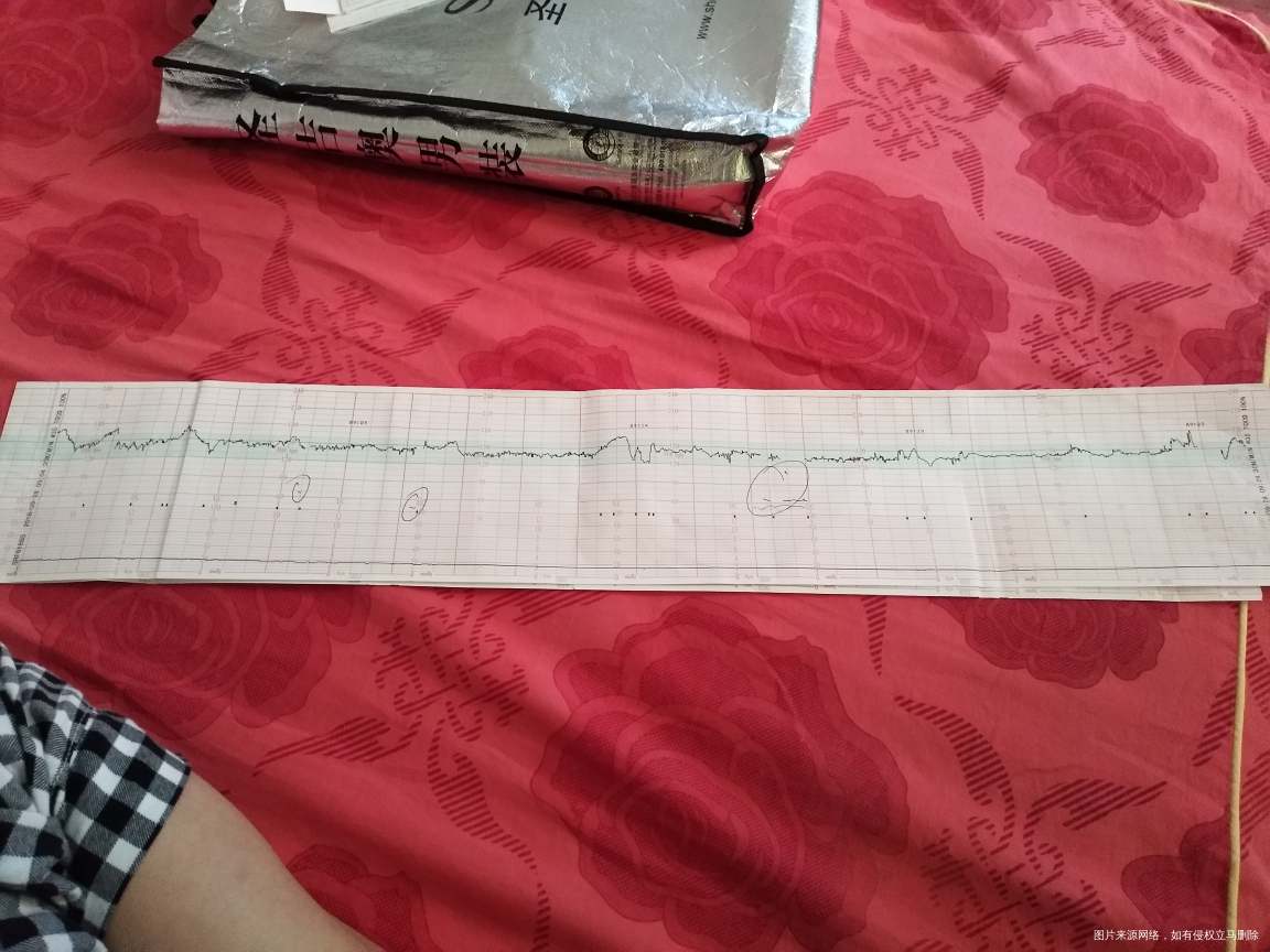 求求求路过医生帮忙看看,急急急