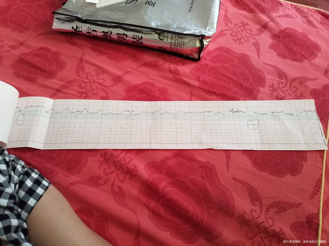 求求求路过医生帮忙看看,急急急