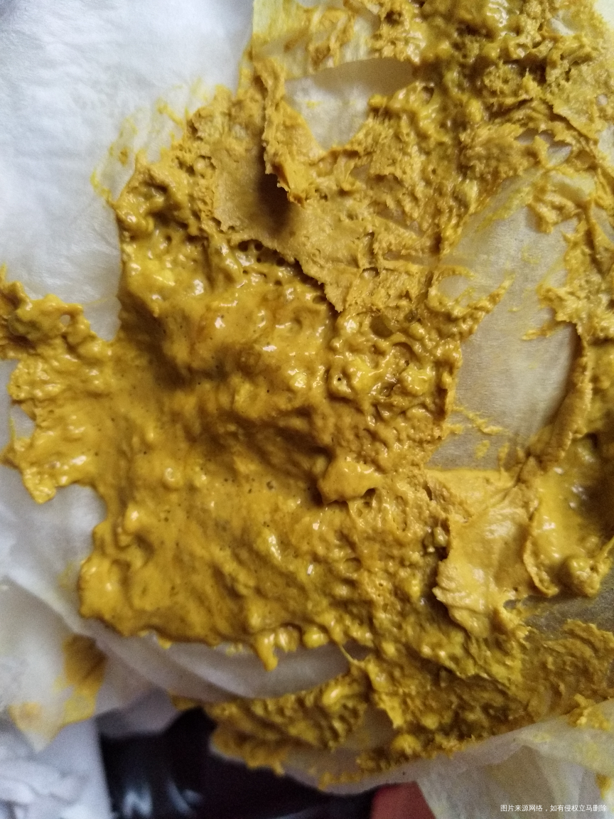 请路过的医生帮忙看看!