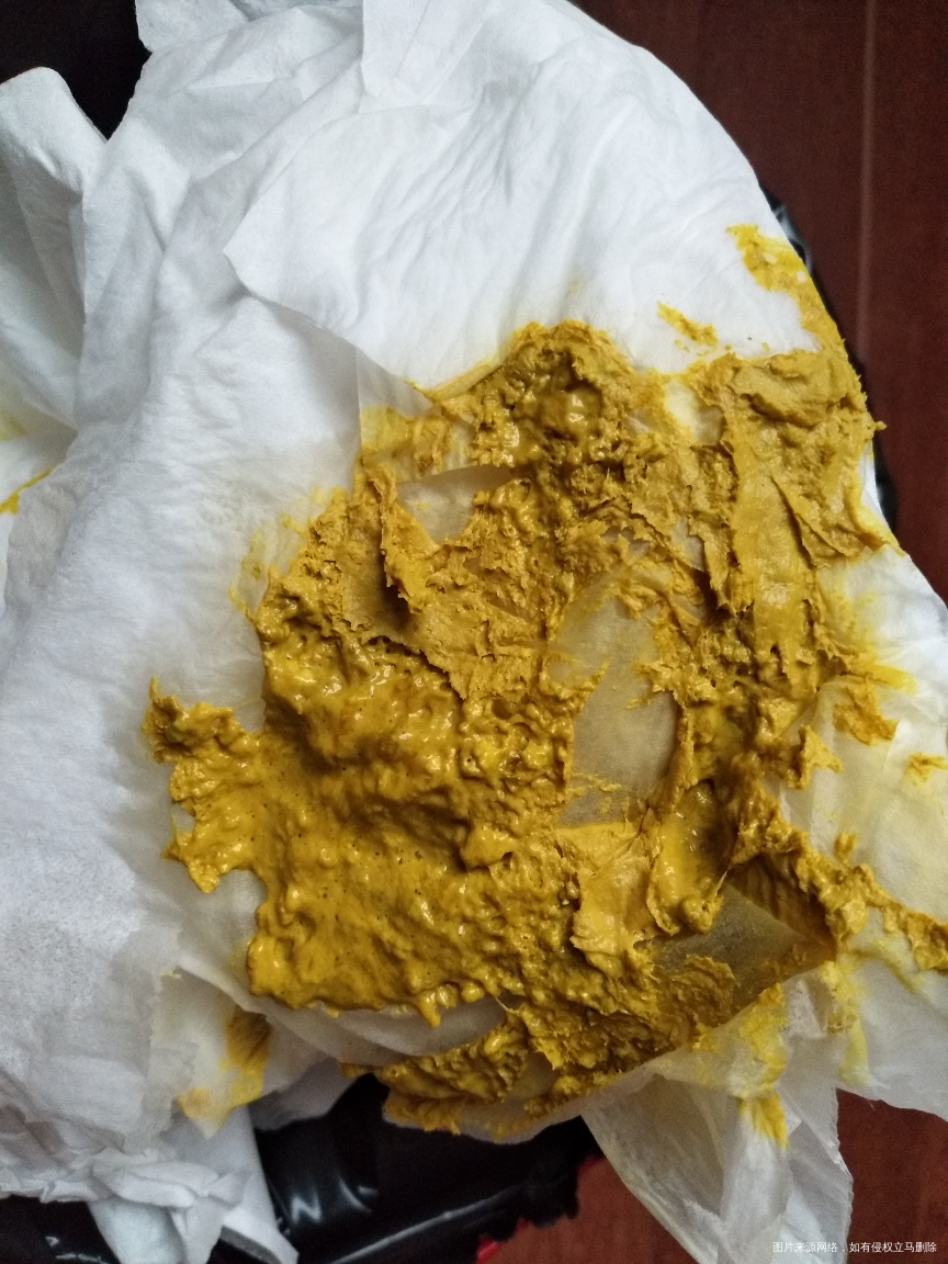 请路过的医生帮忙看看!