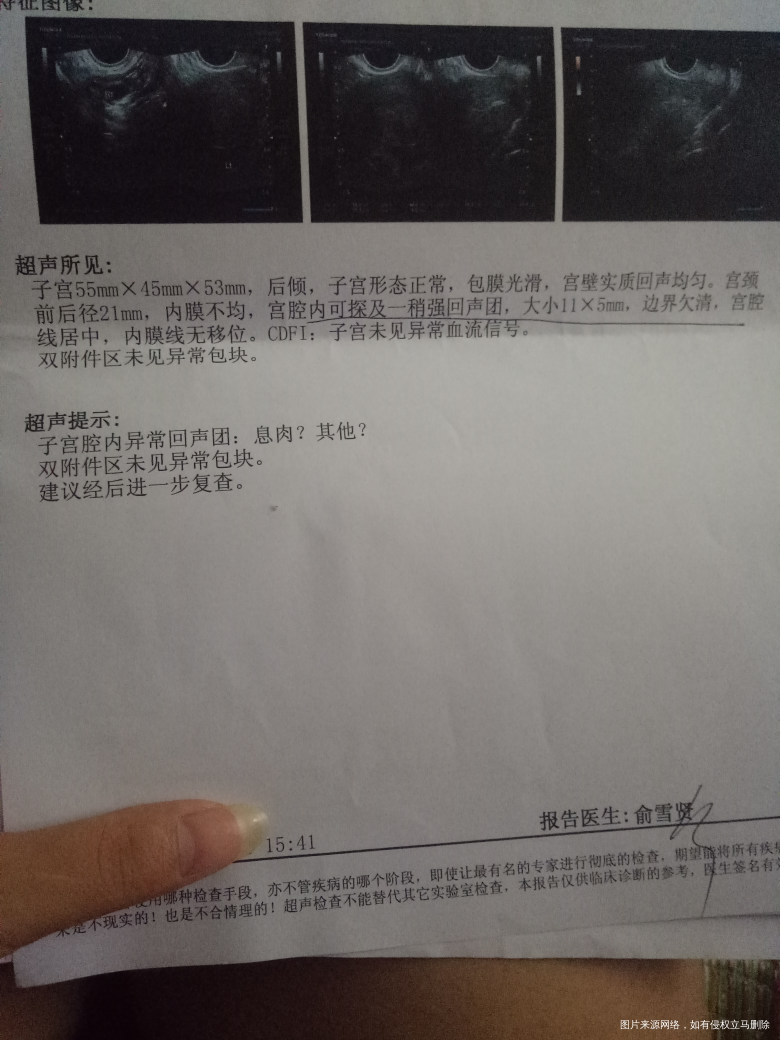我想问一下我这个单子提示的,要做手术吗