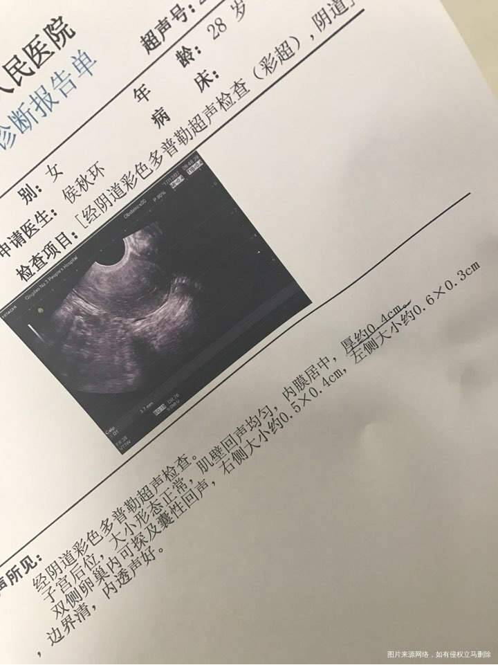 B超单,求医生帮我看看吧