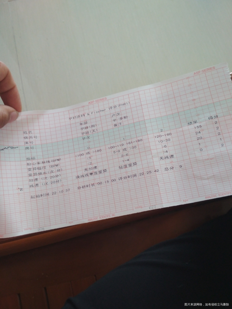 医生帮我看看胎心图,坐等结果。