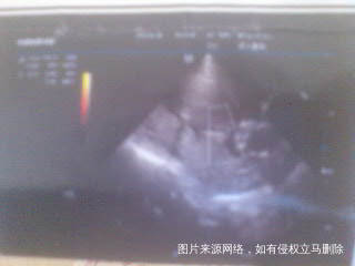 #给我宝贝闺女金金宝贝的一封信