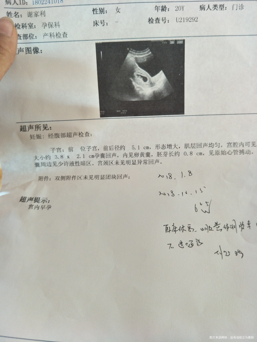 孕酮下降 还有褐色分泌物有胎心胎芽。