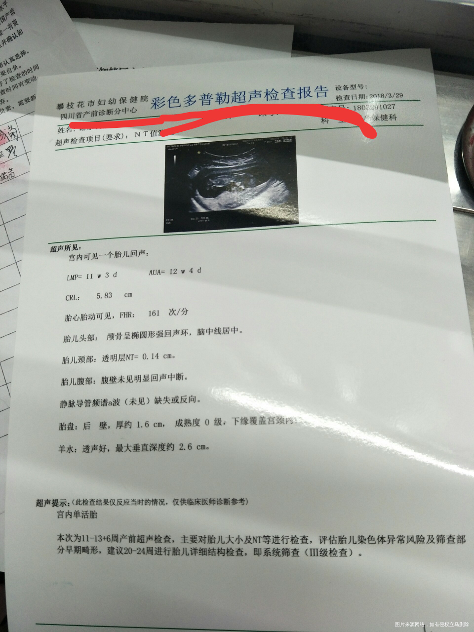 胎盘位置好吗?nt检查。