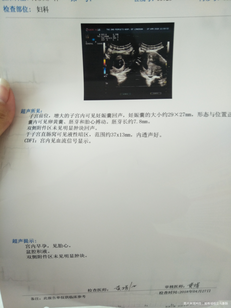 今天早上去B超了医生说符合五十多天