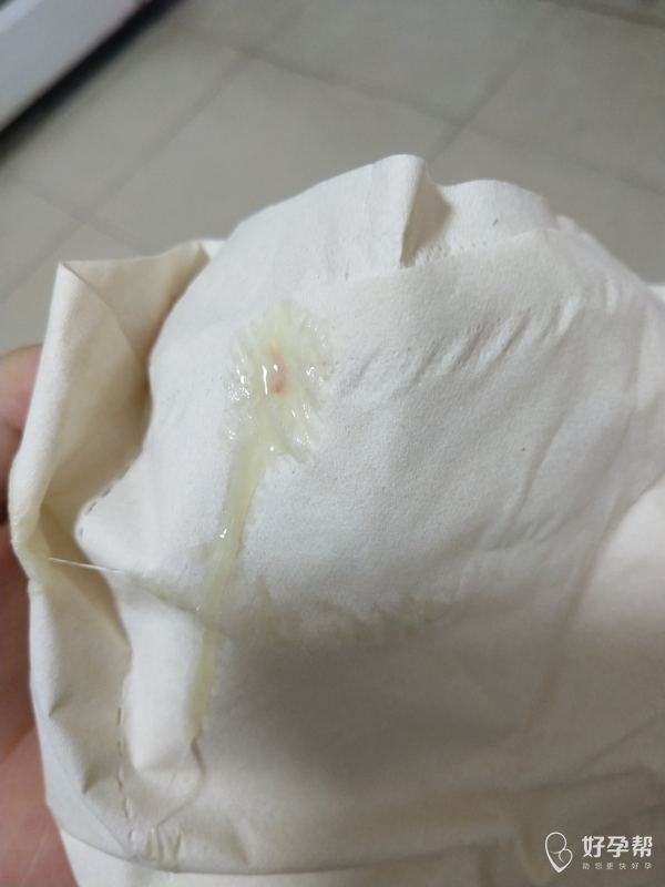 末次月经4月28,5月22日排卵,本周二上午白带里带血丝,去医院照b超宫