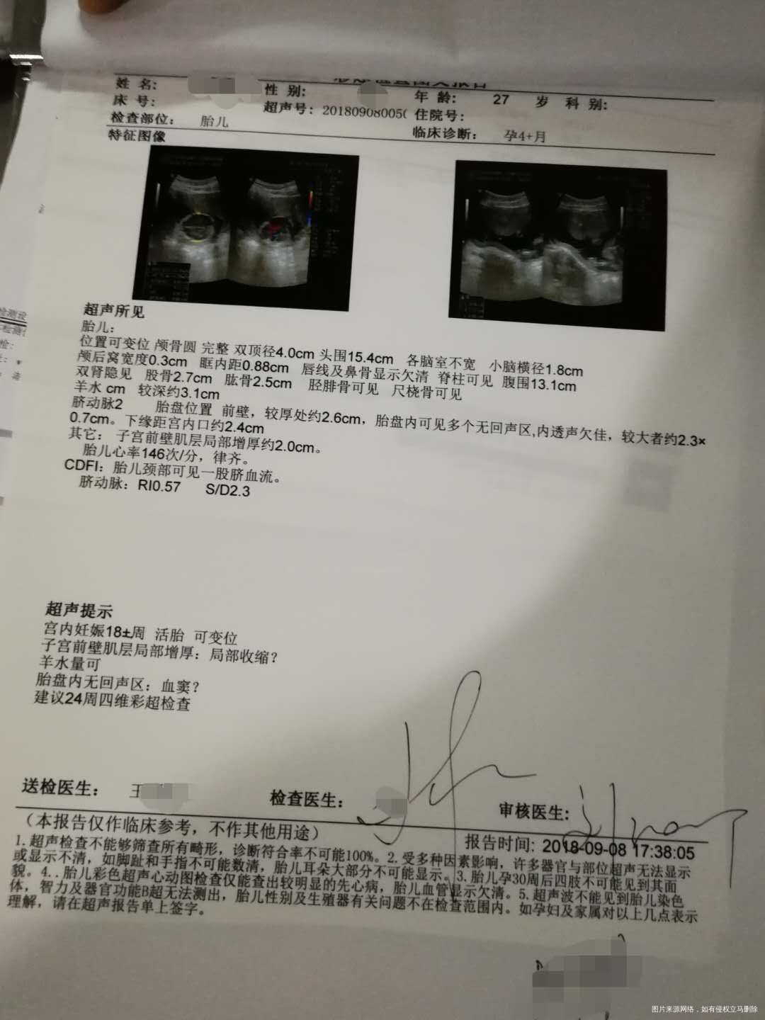 昨天彩超检查局部宫缩,请问严重吗?