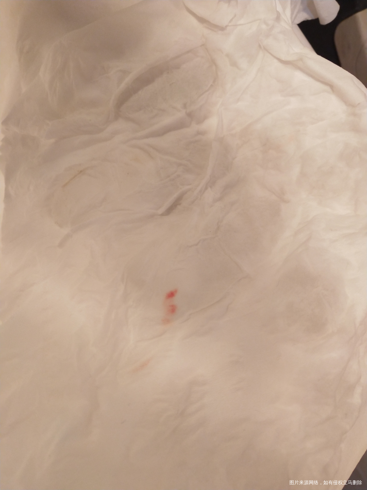 孕36+1,请问这是见红吗?