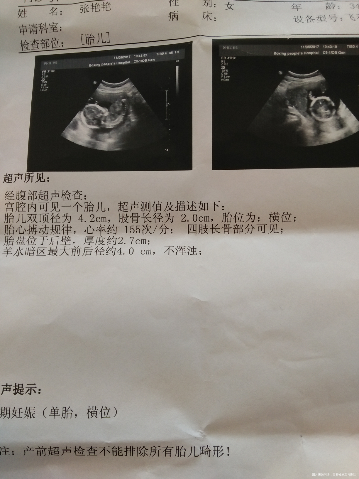 姐妹们,有会看B超单的吗?