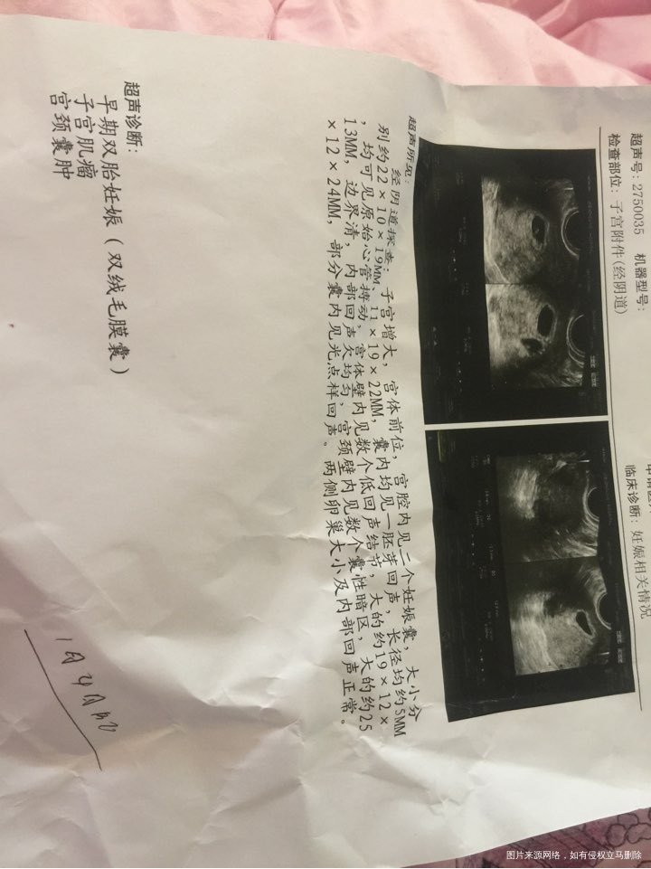 终于熬到一超了,好孕归来