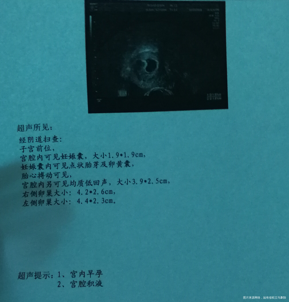 今天中午出血了去B超,请帮忙看看结果怎么样,胚胎正常吗