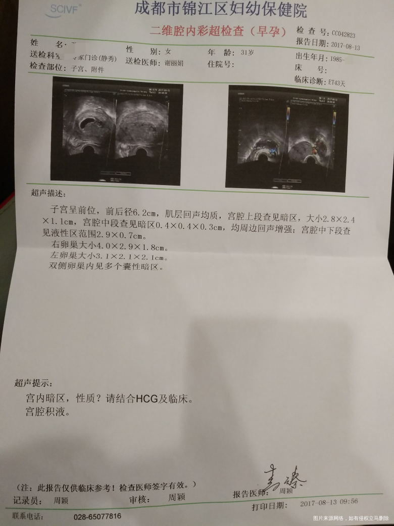 囊胚移植43天,85年女