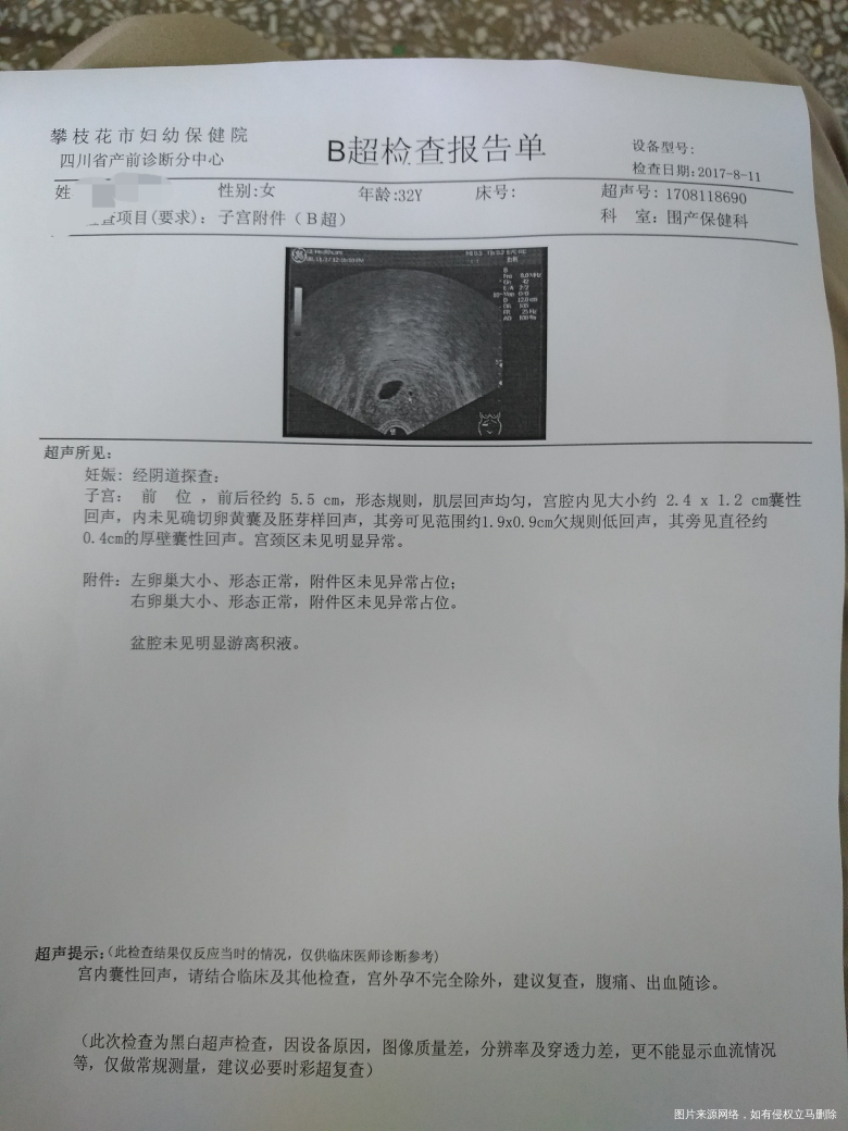 囊胚移植43天,85年女