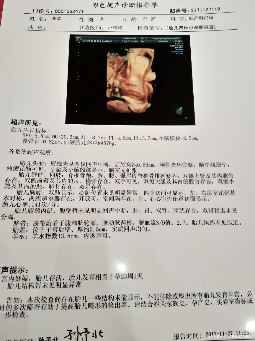 四维顺利通过了,好开心