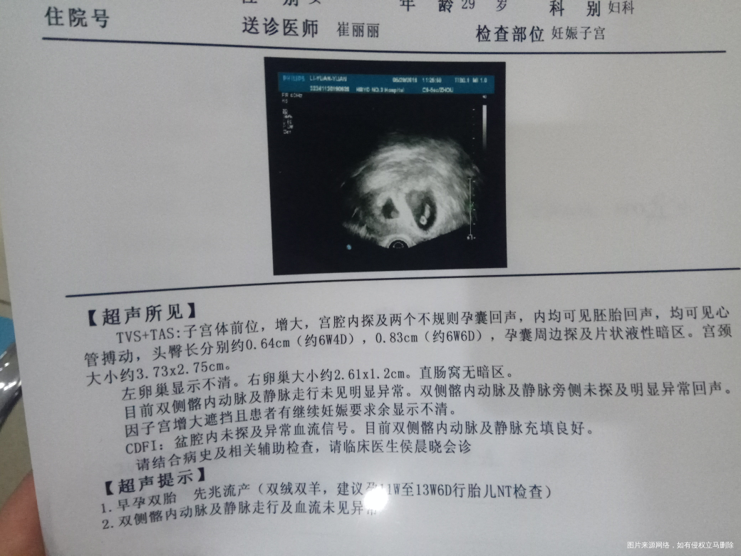 移植冻胚成功后一个月了,断断续续出现出血