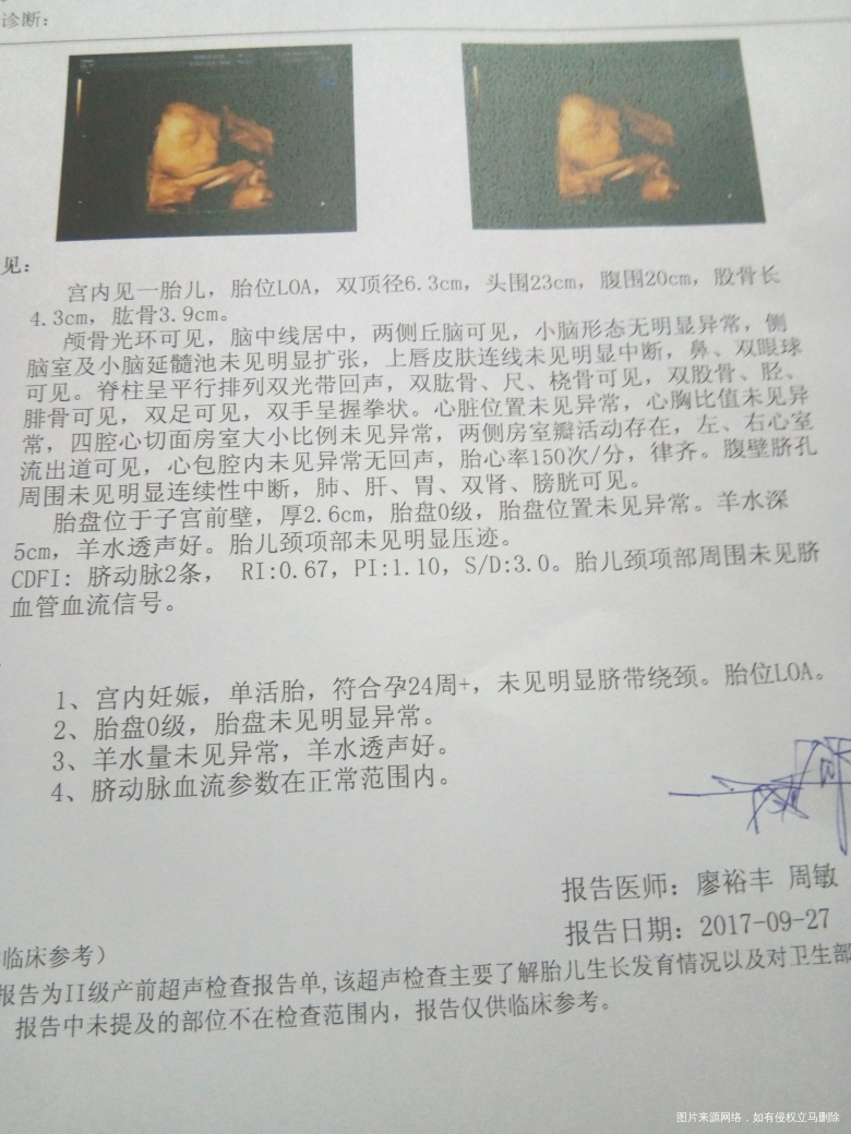 在线的医生帮我看下结果急,急,急,