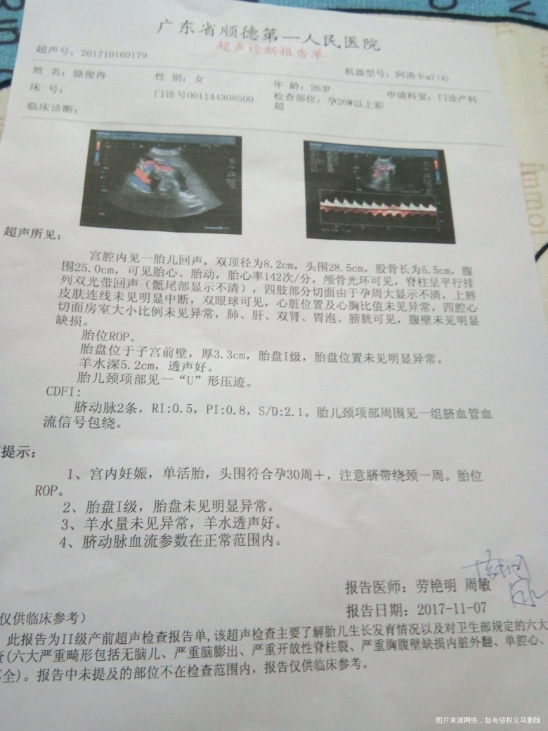有在线医生吗?帮我看下B超检查结果,急急急