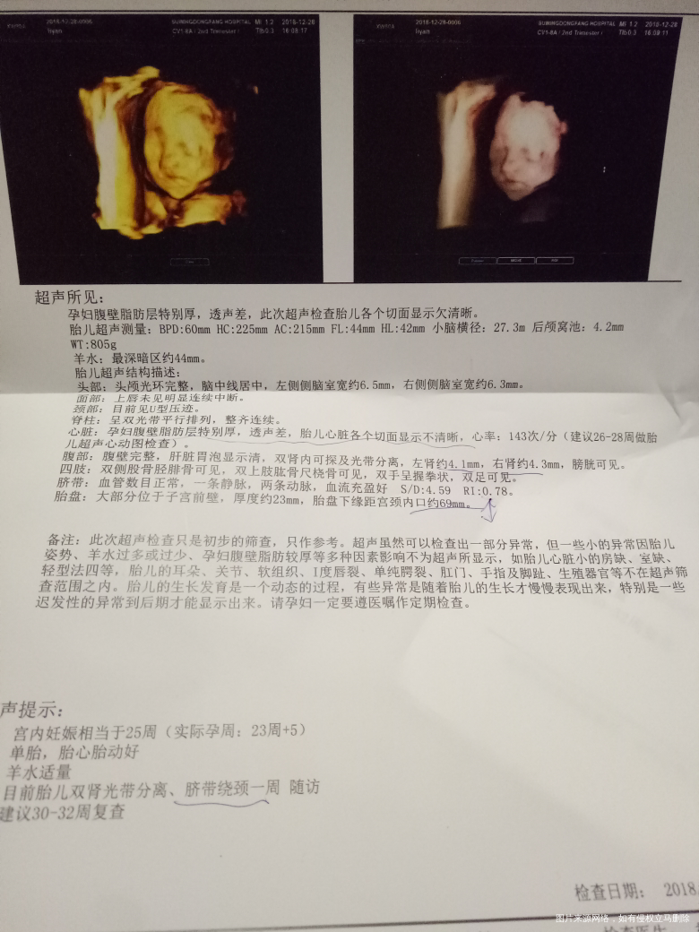 有懂看四维的么?肚皮太厚看不清.这这心脏还要再查么?