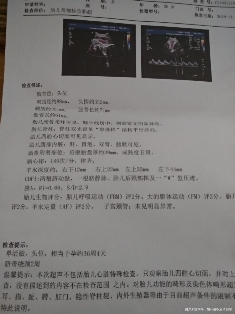 36+6胎儿偏小,胎儿体重身高正常吗,B超单没写?医生帮忙看看