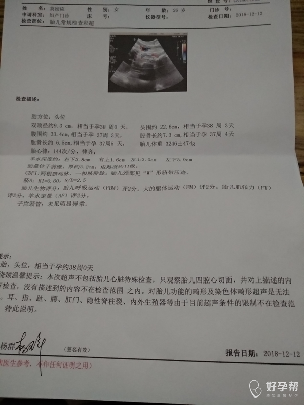 求助医生请帮忙看看,预产期过羷2天了一点动静都没有