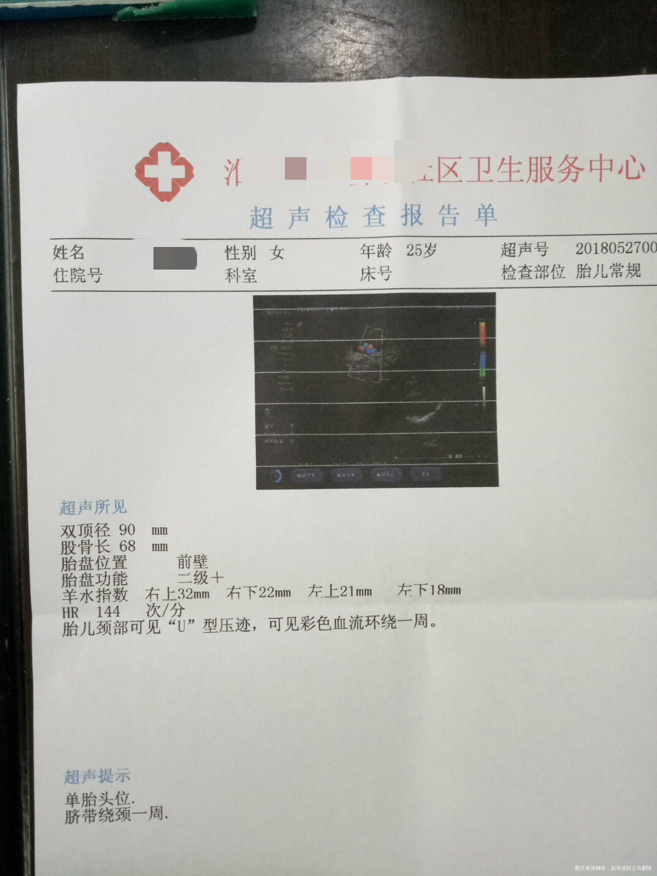 有在线医生吗?帮忙看看,谢谢!