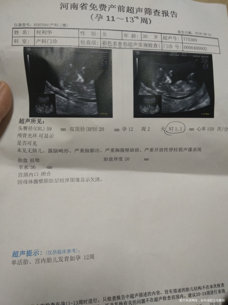 黄体酮早两粒,晚两粒,今天医生让直接停了,不用减量,可以直接停吗?