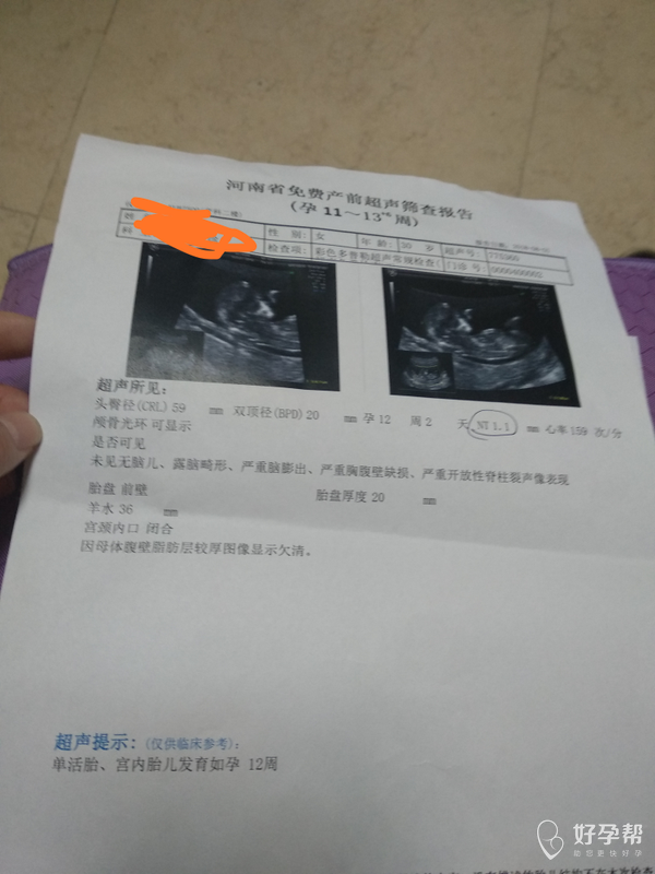 谁能看出男孩女孩才做的nt检查