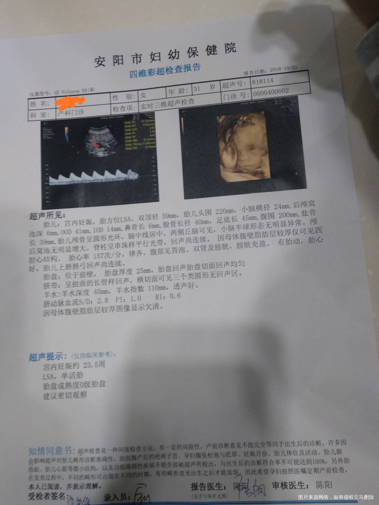 今天做了四维彩超,帮忙看看,医生说我太胖,很多地方看不到,无创低风险。