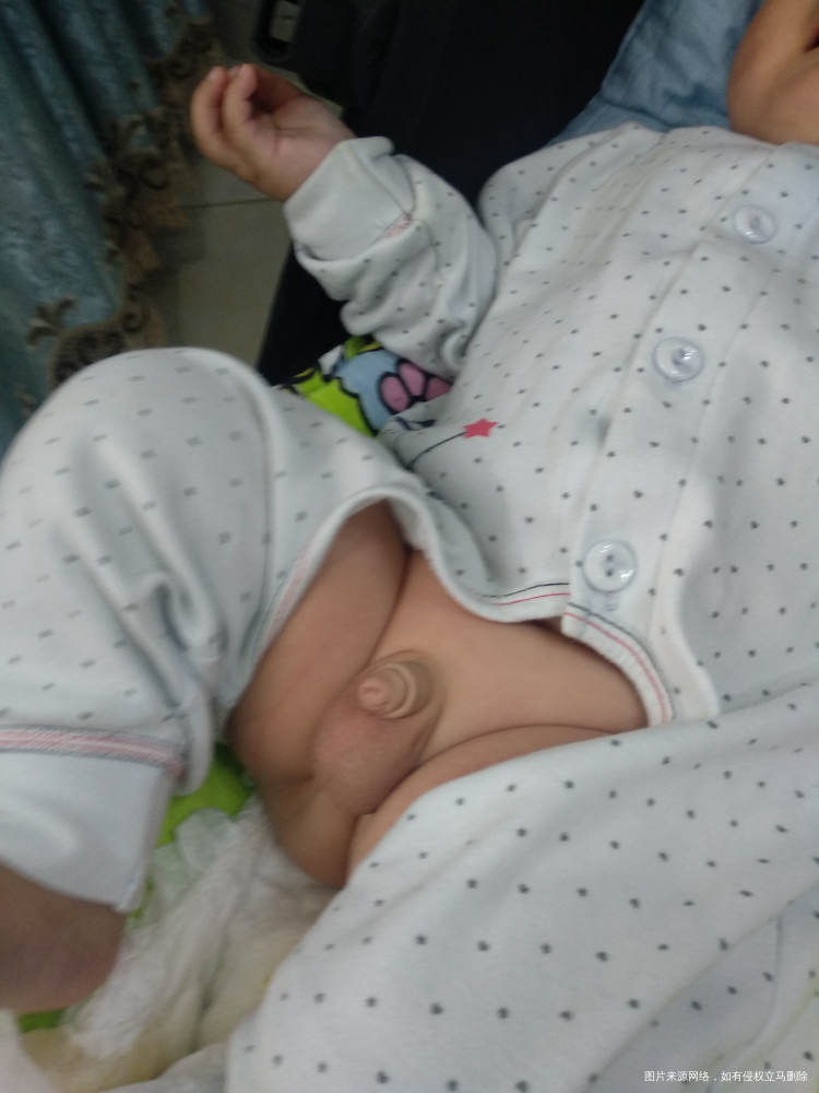 三个半月小孩的小鸡鸡正常吗?