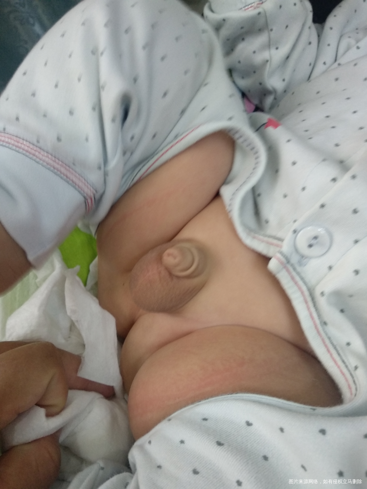 三个半月小孩的小鸡鸡正常吗?