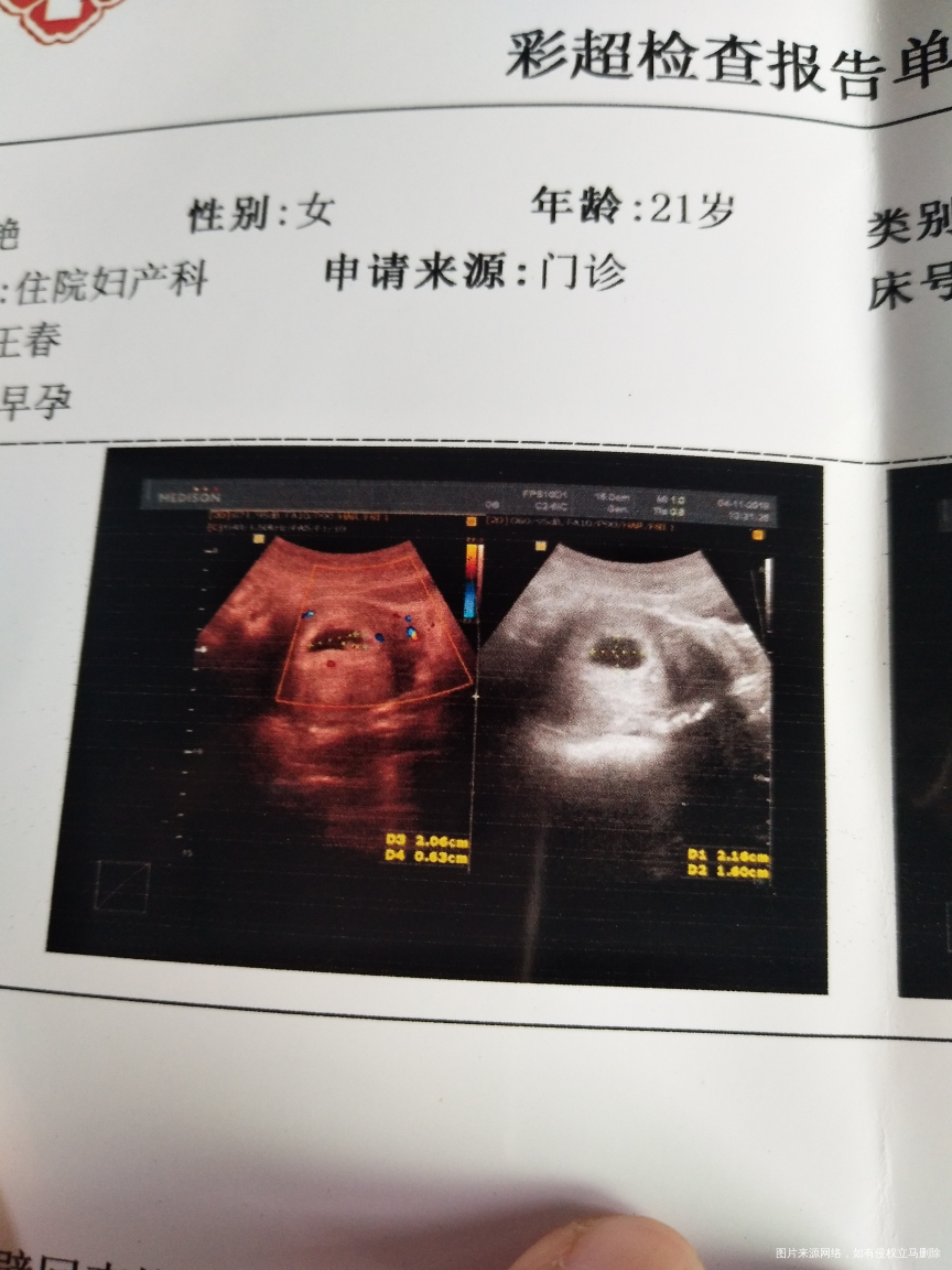 怎么我发的帖子,没有姐妹们帮我解答一下呀